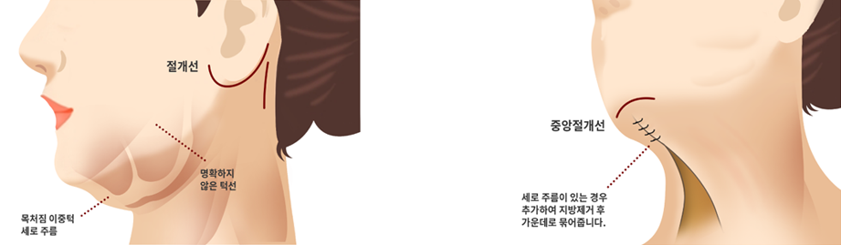 화살코
